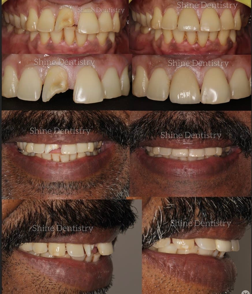 Shine Dentistry 4